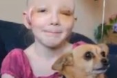 Pet Chihuahua Saves Girl From Pitbull Attack